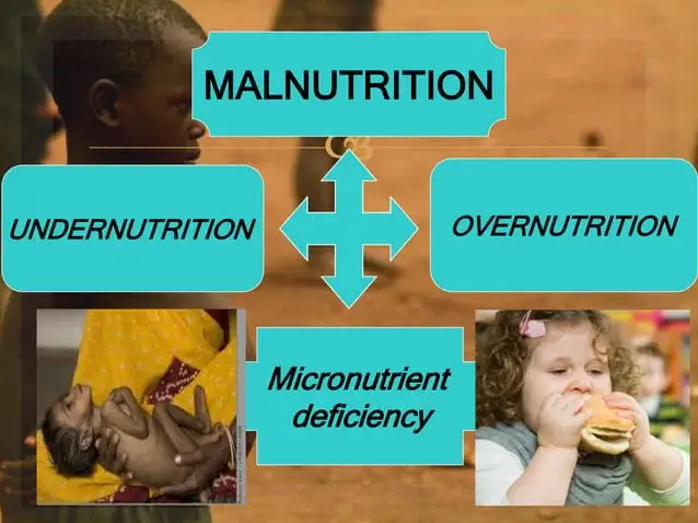 Malnutrition