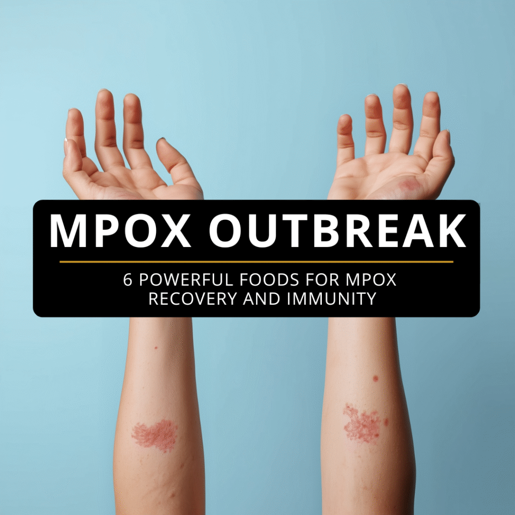 Image showing a pair of human forearms with red rashes and spots, representing Mpox symptoms, placed against a solid light blue background. A dark semi-transparent banner across the center contains bold white text reading “MPOX OUTBREAK” and a subtitle “6 Powerful Foods for Mpox Recovery and Immunity.” The image conveys a health alert theme, focusing on illness awareness and immune support.