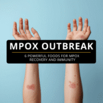 Mpox Diet Tips: 6 Powerful Foods for Mpox Recovery and Immunity