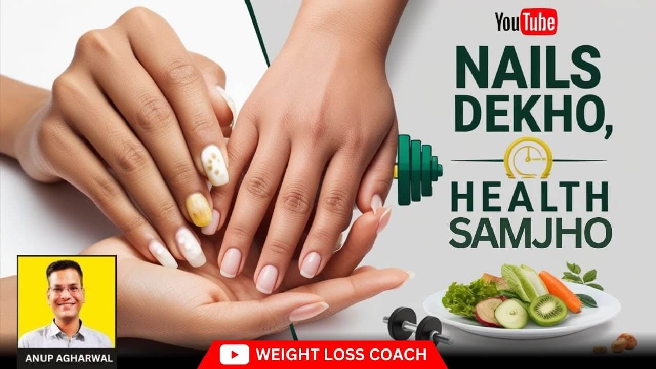Close-up of hands showing healthy and unhealthy nails, accompanied by the text "Nails Dekho, Health Samjho" with health icons, fruits, vegetables, and fitness elements, highlighting a YouTube video by Anup Agharwal, Weight Loss Coach.