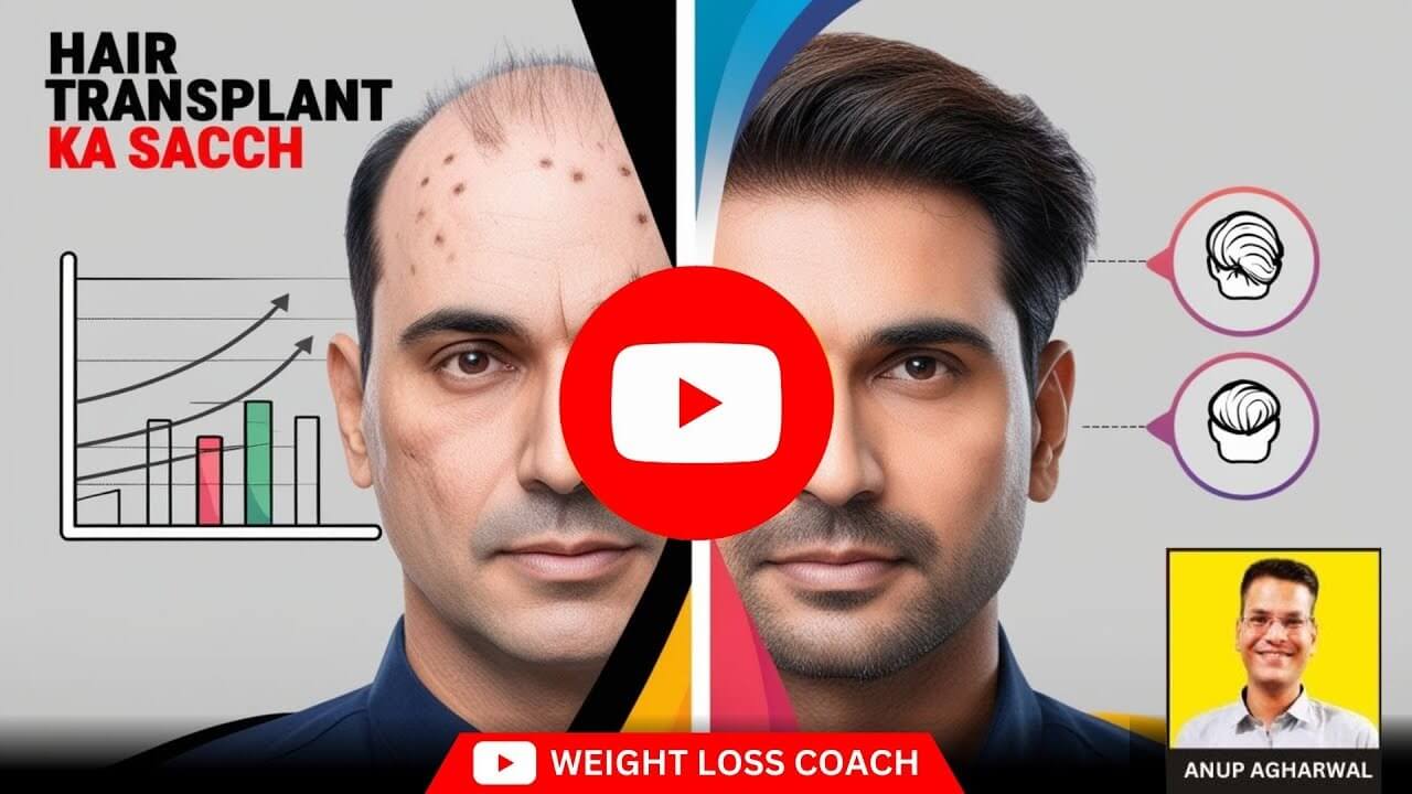 Split image showing a man before and after a hair transplant, with the left side depicting baldness and hair thinning, and the right side showing thick, restored hair. Graphs and icons illustrate hair growth data and transplant techniques. Text reads “Hair Transplant Ka Sacch” with Anup Agharwal's photo and a YouTube play button in the center.
