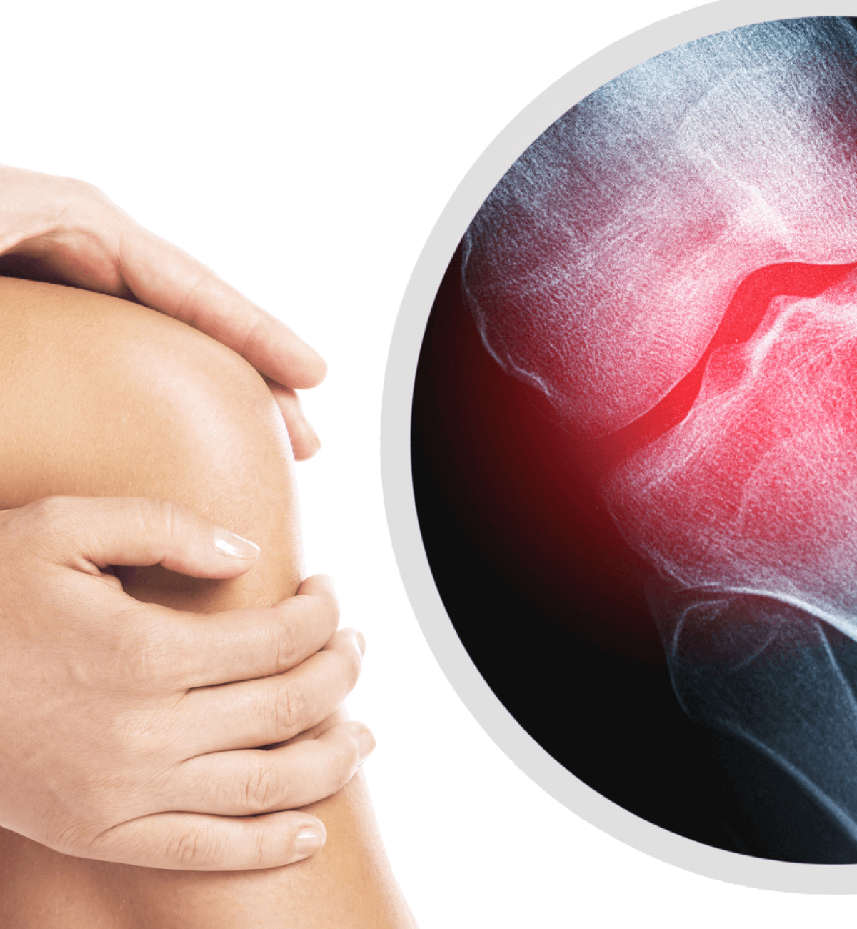 Joint Pain and Bone Health Awareness bone and joint health diet plan – prevent osteoporosis and arthritis